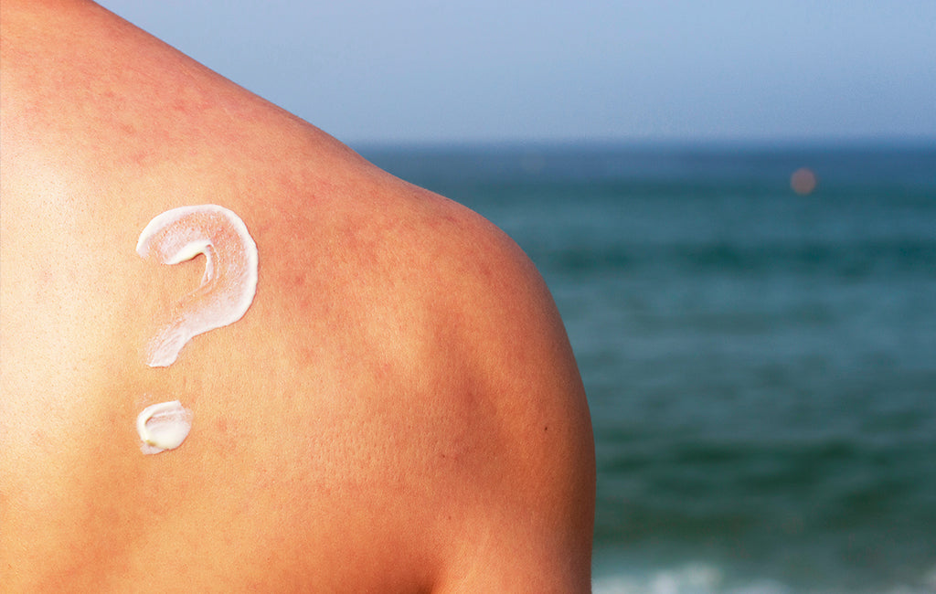 CBD Lotion for Sunburn and Summer Skin