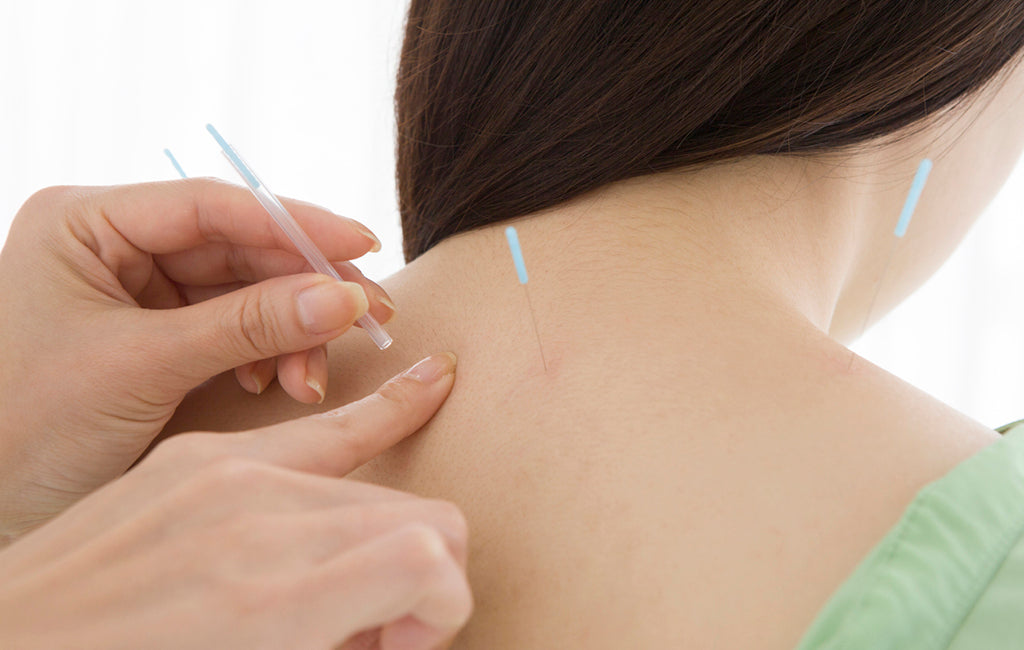 acupuncture for neck
