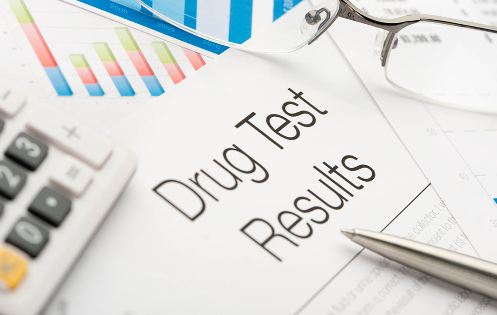 Does CBD Show Up On a Drug Test? - Zebra CBD Does CBD Show Up On a Drug Test? - Zebra CBD